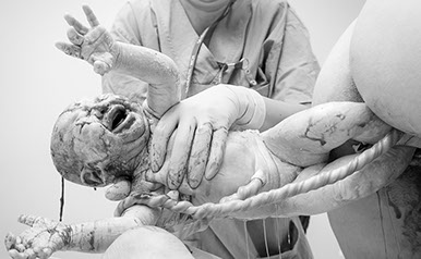 baby being born